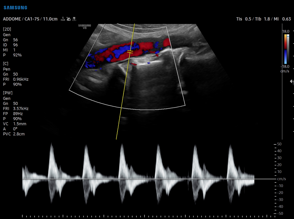 Eco Color Doppler Gargiulo