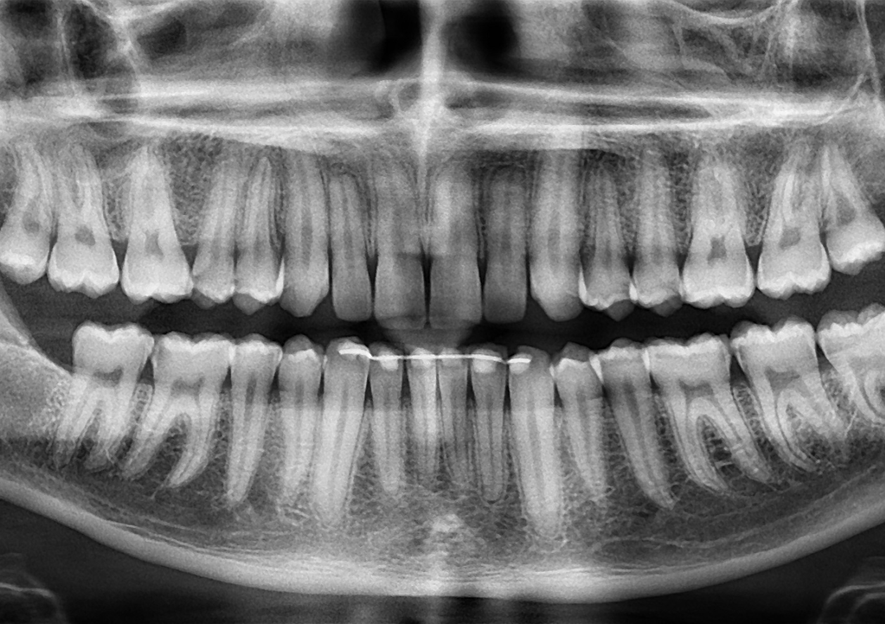 Radiologia odontoiatrica Gargiulo