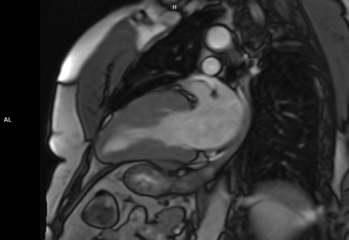 RM Cardiaca Gargiulo