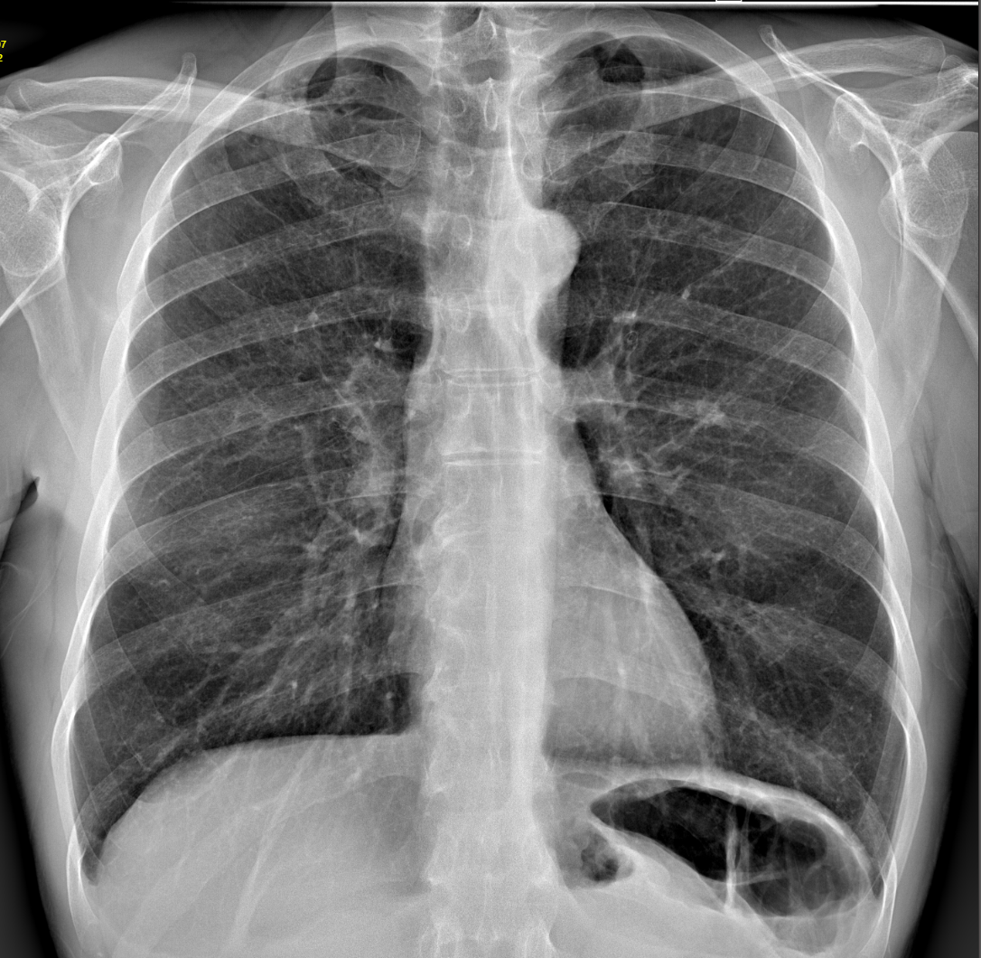 Radiologia digitale Gargiulo