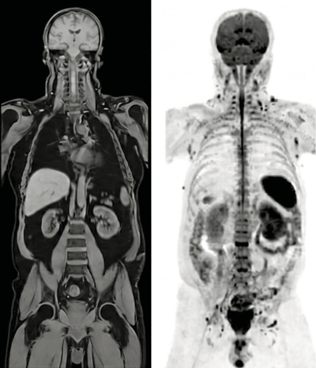 Risonanza Magnetica Whole Body